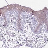 Anti-DSP antibody produced in rabbit Prestige Antibodies&#174; Powered by Atlas Antibodies, affinity isolated antibody, buffered aqueous glycerol solution