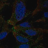 Anti-TMEM178A antibody produced in rabbit Prestige Antibodies® Powered by Atlas Antibodies, affinity isolated antibody, buffered aqueous glycerol solution
