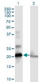 Anti-COMMD1 antibody produced in mouse purified immunoglobulin, buffered aqueous solution