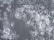 Assay Ready MB49 Mouse Bladder Carcinoma Cell Line