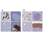 Anti-RHCG antibody produced in rabbit Prestige Antibodies® Powered by Atlas Antibodies, affinity isolated antibody, buffered aqueous glycerol solution