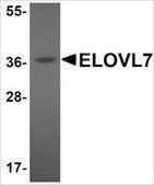 Anti-ELOVL7 antibody produced in rabbit affinity isolated antibody, buffered aqueous solution