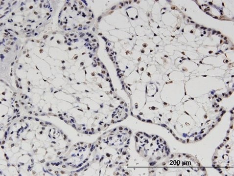 Monoclonal Anti-TBX22, (C-terminal) antibody produced in mouse clone 1A10, purified immunoglobulin, buffered aqueous solution