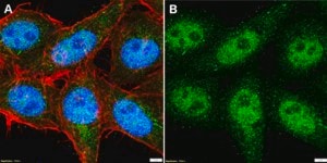 Anti-TRIM63 Antibody, clone 3M21 ZooMAb® Rabbit Monoclonal recombinant, expressed in HEK 293 cells