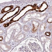 Anti-SCIN antibody produced in rabbit Prestige Antibodies&#174; Powered by Atlas Antibodies, affinity isolated antibody, buffered aqueous glycerol solution, Ab1