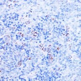Anti- SHMT2 antibody produced in rabbit