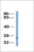 Anti-C4BPB antibody produced in rabbit affinity isolated antibody