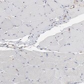 Anti-RAB9A antibody produced in rabbit affinity isolated antibody, buffered aqueous glycerol solution