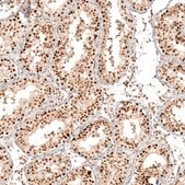 Anti-KIAA1551 antibody produced in rabbit Prestige Antibodies&#174; Powered by Atlas Antibodies, affinity isolated antibody, buffered aqueous glycerol solution