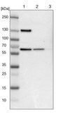 Anti-UPF3B antibody produced in rabbit Ab1, Prestige Antibodies&#174; Powered by Atlas Antibodies, affinity isolated antibody, buffered aqueous glycerol solution