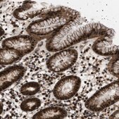 Anti-MELK antibody produced in rabbit Prestige Antibodies&#174; Powered by Atlas Antibodies, affinity isolated antibody, buffered aqueous glycerol solution