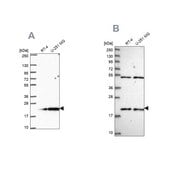Anti-KIAA1143 antibody produced in rabbit Prestige Antibodies® Powered by Atlas Antibodies, affinity isolated antibody
