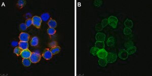 Anti-Anosmin Antibody, clone 2C17 ZooMAb® Rabbit Monoclonal recombinant, expressed in HEK 293 cells