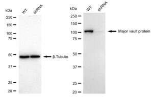 KD-Validated Anti Major Vault Protein Antibody, clone 24GB465, Rabbit Monoclonal clone 24GB465, recombinant rabbit monoclonal, expressed in HEK293 cells