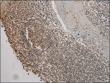 Anti-UBE2B affinity isolated antibody