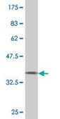 Monoclonal Anti-SPAST antibody produced in mouse clone 2F5, purified immunoglobulin, buffered aqueous solution