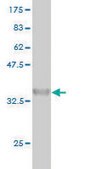 Monoclonal Anti-ARAF antibody produced in mouse clone 6H6, purified immunoglobulin, buffered aqueous solution
