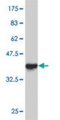 Monoclonal Anti-FAP antibody produced in mouse clone 1E5, purified immunoglobulin, buffered aqueous solution