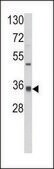 ANTI-CRYL1 (C-TERM) antibody produced in rabbit IgG fraction of antiserum, buffered aqueous solution