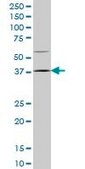 Monoclonal Anti-HOXD9 antibody produced in mouse clone 2A9, purified immunoglobulin, buffered aqueous solution
