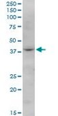 Anti-FBXO28 antibody produced in mouse purified immunoglobulin, buffered aqueous solution