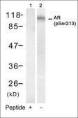 Anti-phospho-AR (pSer213) antibody produced in rabbit affinity isolated antibody