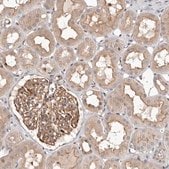Anti-GLRX3 antibody produced in rabbit Prestige Antibodies&#174; Powered by Atlas Antibodies, affinity isolated antibody, buffered aqueous glycerol solution