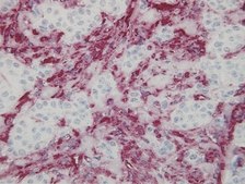 Anti-Vimentin Antibody, clone V9 clone V9, Chemicon®, from mouse