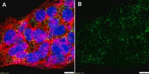 Anti-SGK1 Antibody, clone 2N11 ZooMAb&#174; Rabbit Monoclonal recombinant, expressed in HEK 293 cells