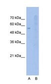 Anti-SLC22A1 (AB1) antibody produced in rabbit IgG fraction of antiserum