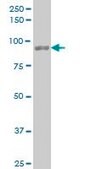 Monoclonal Anti-UBTF antibody produced in mouse clone 1A2, purified immunoglobulin, buffered aqueous solution