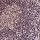 Anti-SCAF11 antibody produced in rabbit Prestige Antibodies® Powered by Atlas Antibodies, affinity isolated antibody, buffered aqueous glycerol solution