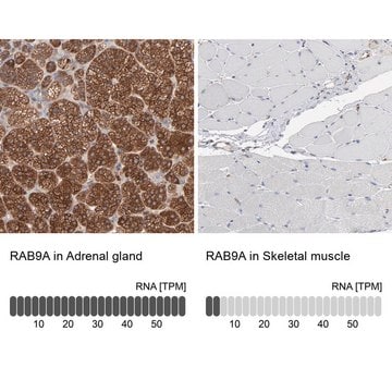 Anti-RAB9A antibody produced in rabbit affinity isolated antibody, buffered aqueous glycerol solution