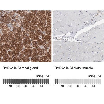 Anti-RAB9A antibody produced in rabbit affinity isolated antibody, buffered aqueous glycerol solution