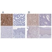 Anti-FBXL16 antibody produced in rabbit Prestige Antibodies&#174; Powered by Atlas Antibodies, affinity isolated antibody, buffered aqueous glycerol solution
