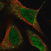Anti-HHLA3 antibody produced in rabbit Prestige Antibodies&#174; Powered by Atlas Antibodies, affinity isolated antibody, buffered aqueous glycerol solution