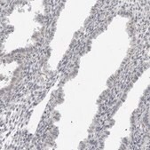 Anti-SUGCT antibody produced in rabbit Prestige Antibodies® Powered by Atlas Antibodies, affinity isolated antibody, buffered aqueous glycerol solution, ab2
