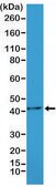 Anti-ACTA2 antibody, Rabbit monoclonal recombinant, expressed in HEK 293 cells, clone RM253, purified immunoglobulin
