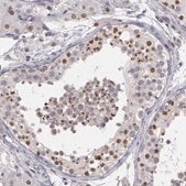 Anti-PRICKLE1 antibody produced in rabbit Prestige Antibodies® Powered by Atlas Antibodies, affinity isolated antibody, buffered aqueous glycerol solution