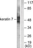 Anti-Keratin 7 antibody produced in rabbit affinity isolated antibody