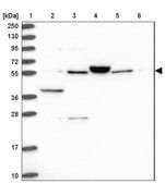 Anti-ACSM6 antibody produced in rabbit Prestige Antibodies&#174; Powered by Atlas Antibodies, affinity isolated antibody, buffered aqueous glycerol solution