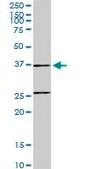 Monoclonal Anti-RUNDC2A antibody produced in mouse clone 6D6, purified immunoglobulin, buffered aqueous solution