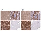 Anti-ABAT antibody produced in rabbit Prestige Antibodies® Powered by Atlas Antibodies, affinity isolated antibody, buffered aqueous glycerol solution