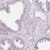 Anti-TEX15 antibody produced in rabbit Prestige Antibodies&#174; Powered by Atlas Antibodies, affinity isolated antibody, buffered aqueous glycerol solution