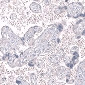 Monoclonal Anti-GPR88 antibody produced in mouse Prestige Antibodies® Powered by Atlas Antibodies, clone CL15190, purified antibody (Protein A)