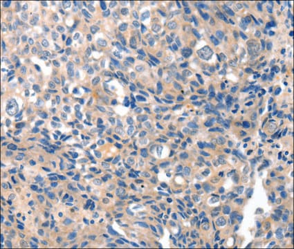 Anti-GRIN2D antibody produced in rabbit affinity isolated antibody