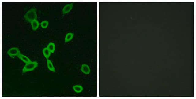 Anti-LGR6 antibody produced in rabbit affinity isolated antibody