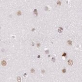 Anti-DGCR14 antibody produced in rabbit Ab2, Prestige Antibodies&#174; Powered by Atlas Antibodies, affinity isolated antibody, buffered aqueous glycerol solution