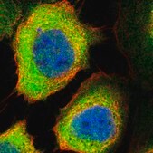 Anti-PPM1L antibody produced in rabbit Prestige Antibodies&#174; Powered by Atlas Antibodies, affinity isolated antibody, buffered aqueous glycerol solution, Ab2