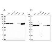 Anti-PRPF19 antibody produced in rabbit Prestige Antibodies&#174; Powered by Atlas Antibodies, affinity isolated antibody, buffered aqueous glycerol solution